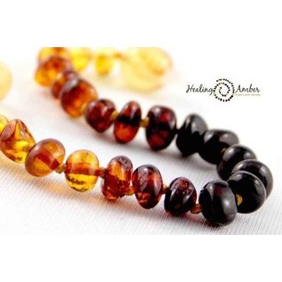 Healing Amber Baltic Amber Necklace - Baby