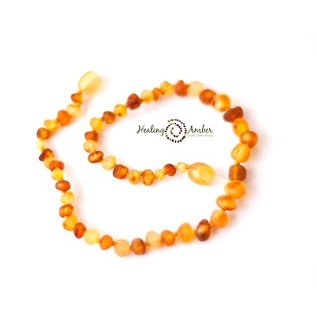 Healing Amber Baltic Amber Necklace - Baby