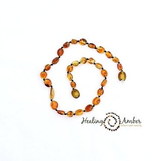 Healing Amber Baltic Amber Necklace - Baby