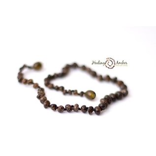 Healing Amber Baltic Amber Necklace - Baby