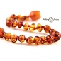 Healing Amber Baltic Amber Necklace - Baby