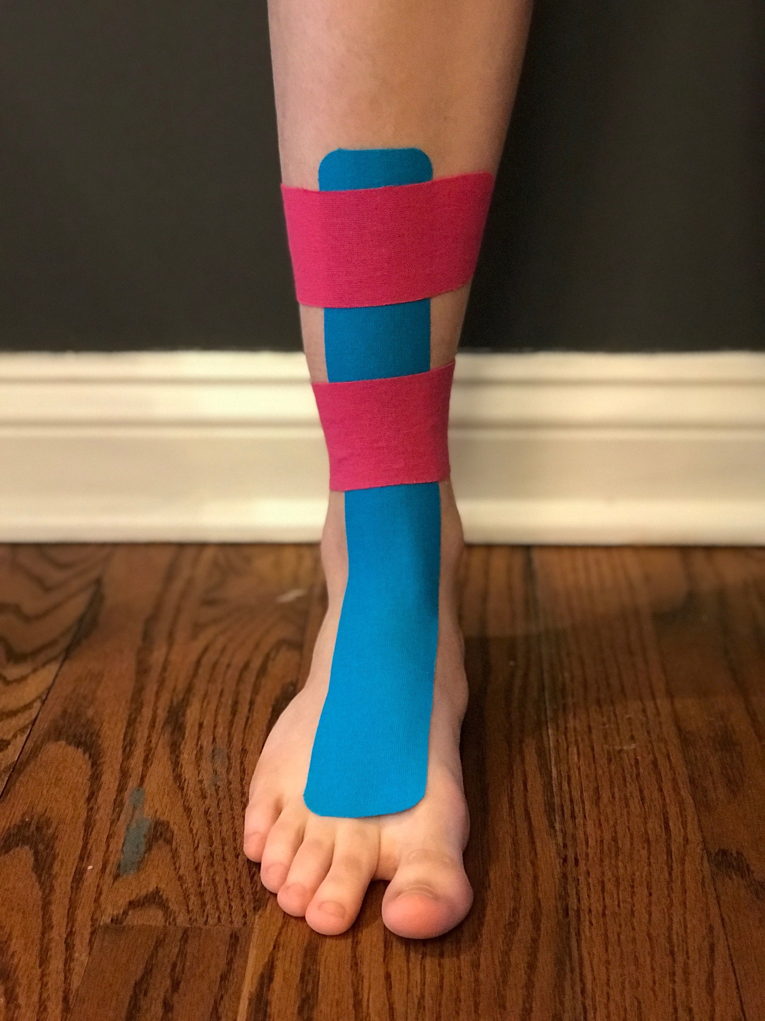 How To Tape Shin Splints Diagram