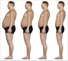 Vitamin D and Weight Loss for Obesity